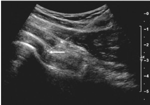 soft-tissue-ultrasound--300x210